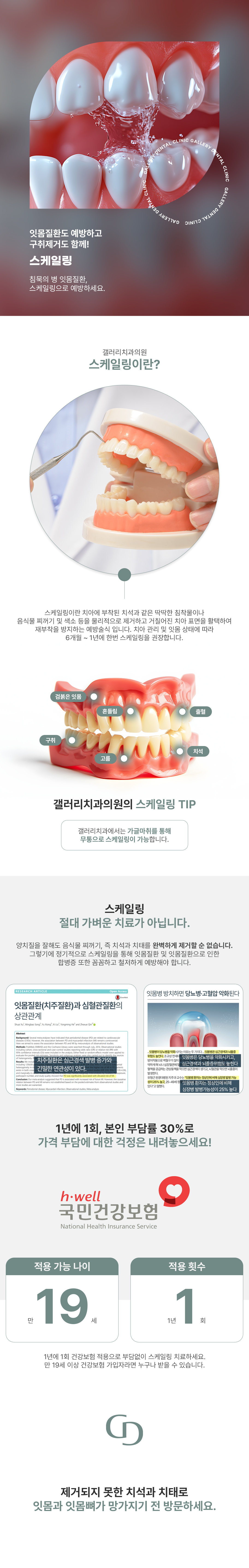 침묵의 병 잇몸질환, 스케일링으로 예방하세요!