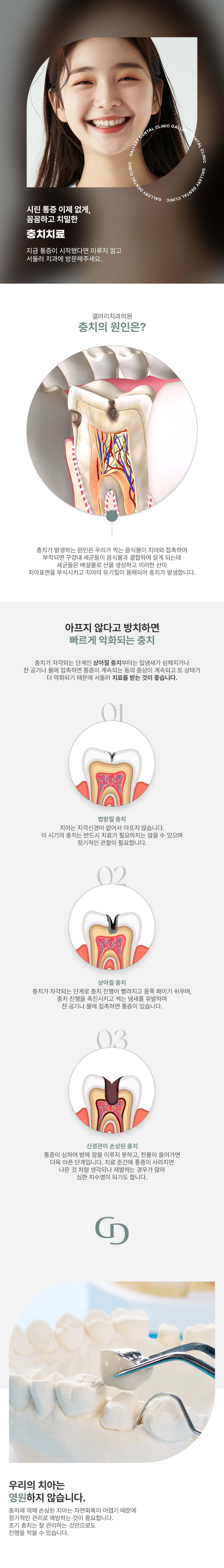 시린 통증 이제 없게, 꼼꼼하고 치밀한 충치치료